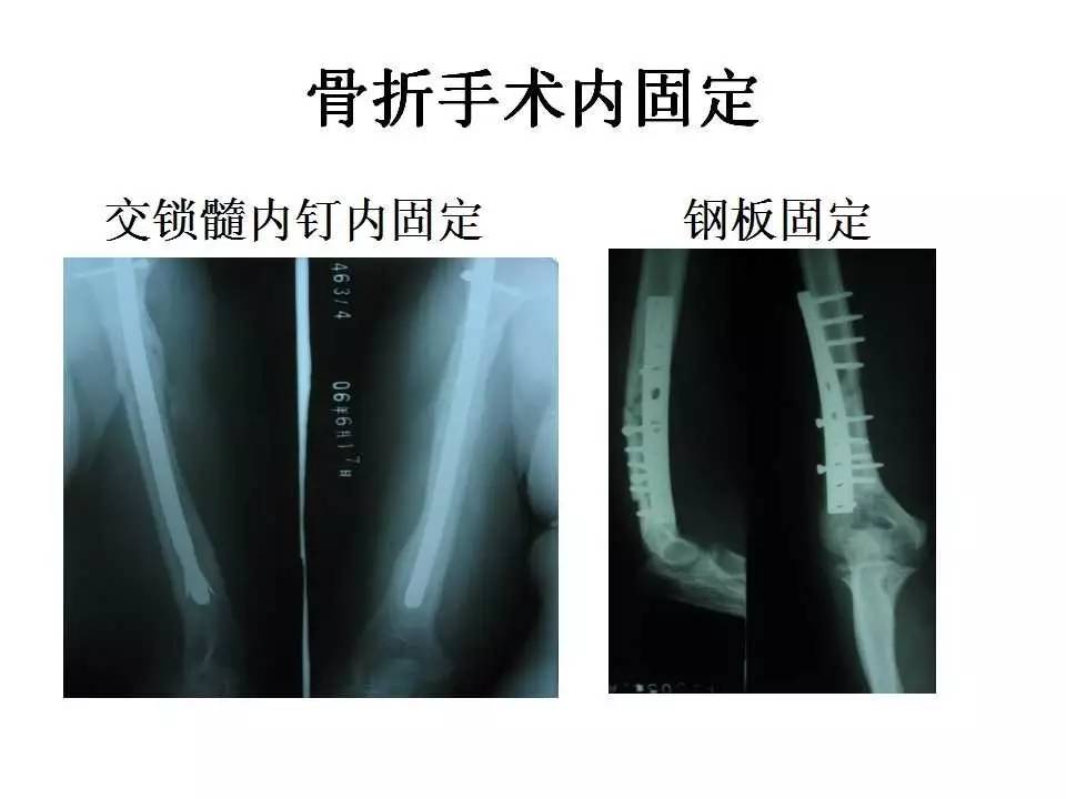 圣母院 产品图片