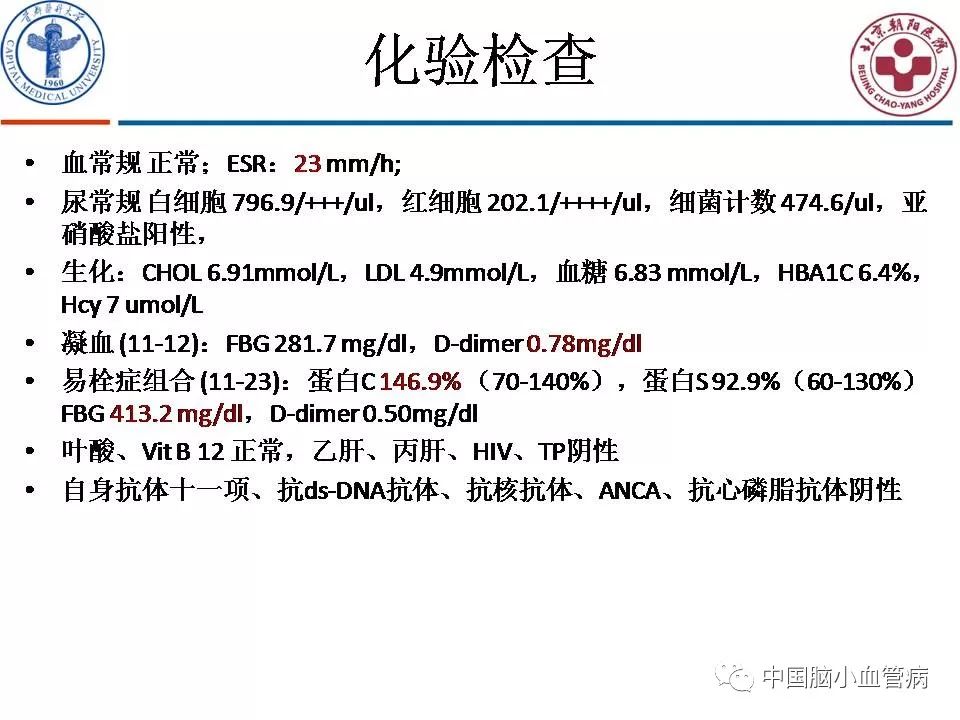信号100 相关产品